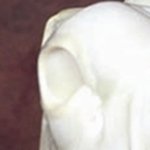 NO Eye (Click Here)